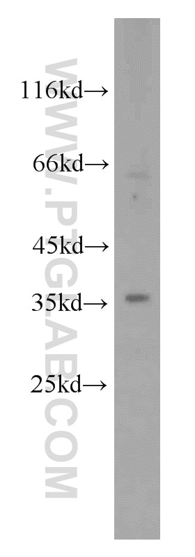 Western Blot (WB) analysis of HeLa cells using RHBDL2 Polyclonal antibody (12467-1-AP)