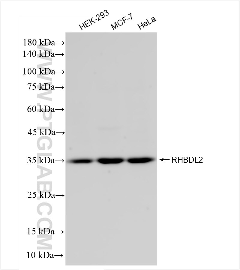 Western Blot (WB) analysis of various lysates using RHBDL2 Recombinant antibody (84589-1-RR)