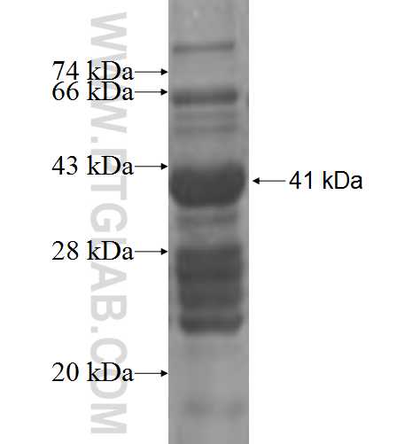 RHBDL2 fusion protein Ag3142 SDS-PAGE