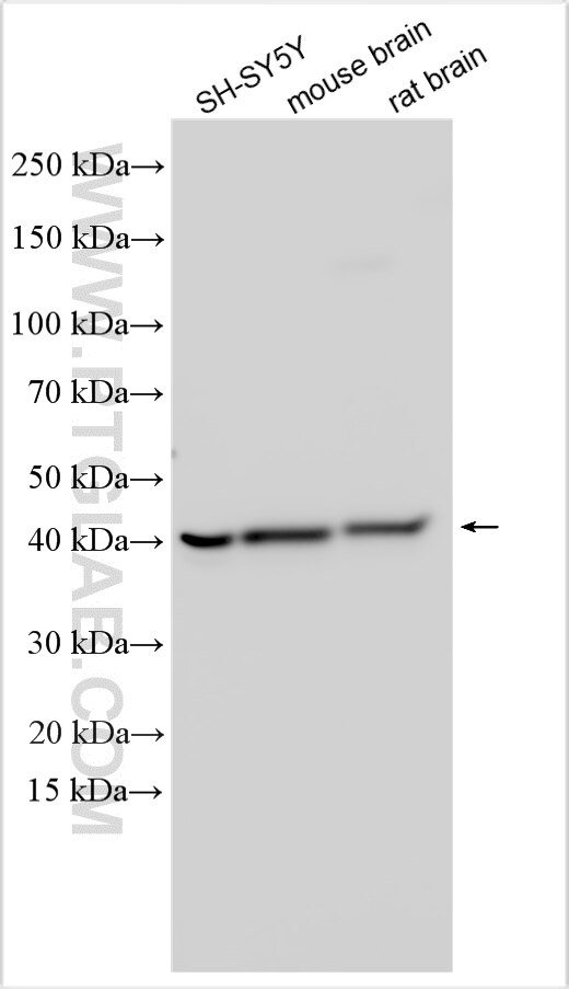 Western Blot (WB) analysis of various lysates using RHBDL3 Polyclonal antibody (21671-1-AP)