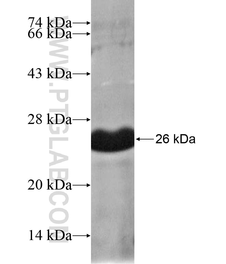 RHBDL3 fusion protein Ag17211 SDS-PAGE