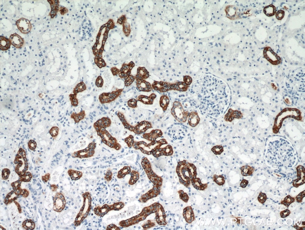 Immunohistochemistry (IHC) staining of human kidney tissue using RHCG Polyclonal antibody (11949-1-AP)
