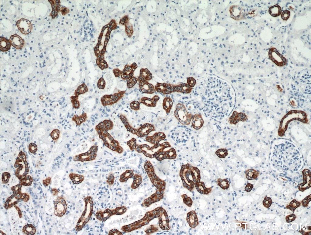 IHC staining of human kidney using 11949-1-AP