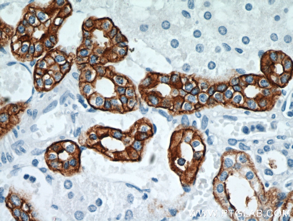 Immunohistochemistry (IHC) staining of human kidney tissue using RHCG Polyclonal antibody (11949-1-AP)