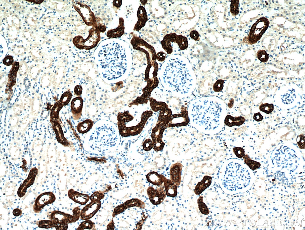 Immunohistochemistry (IHC) staining of human kidney tissue using RHCG Polyclonal antibody (11949-1-AP)