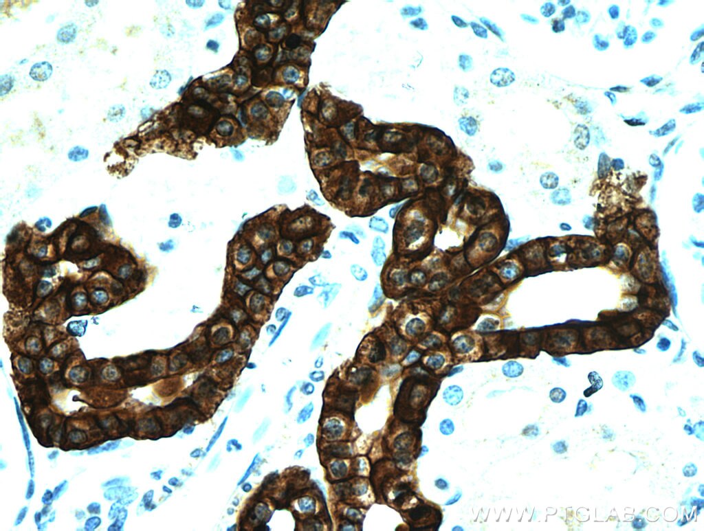 Immunohistochemistry (IHC) staining of human kidney tissue using RHCG Polyclonal antibody (11949-1-AP)