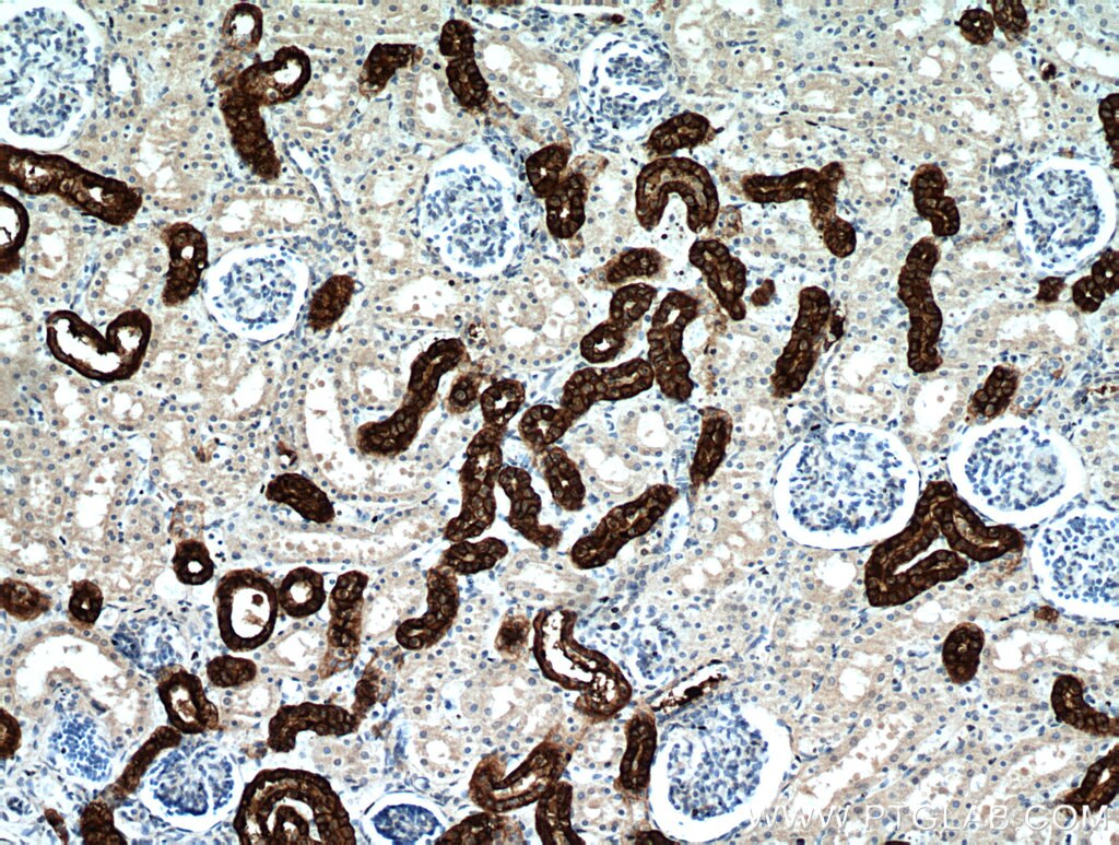 Immunohistochemistry (IHC) staining of human kidney tissue using RHCG Polyclonal antibody (11949-1-AP)