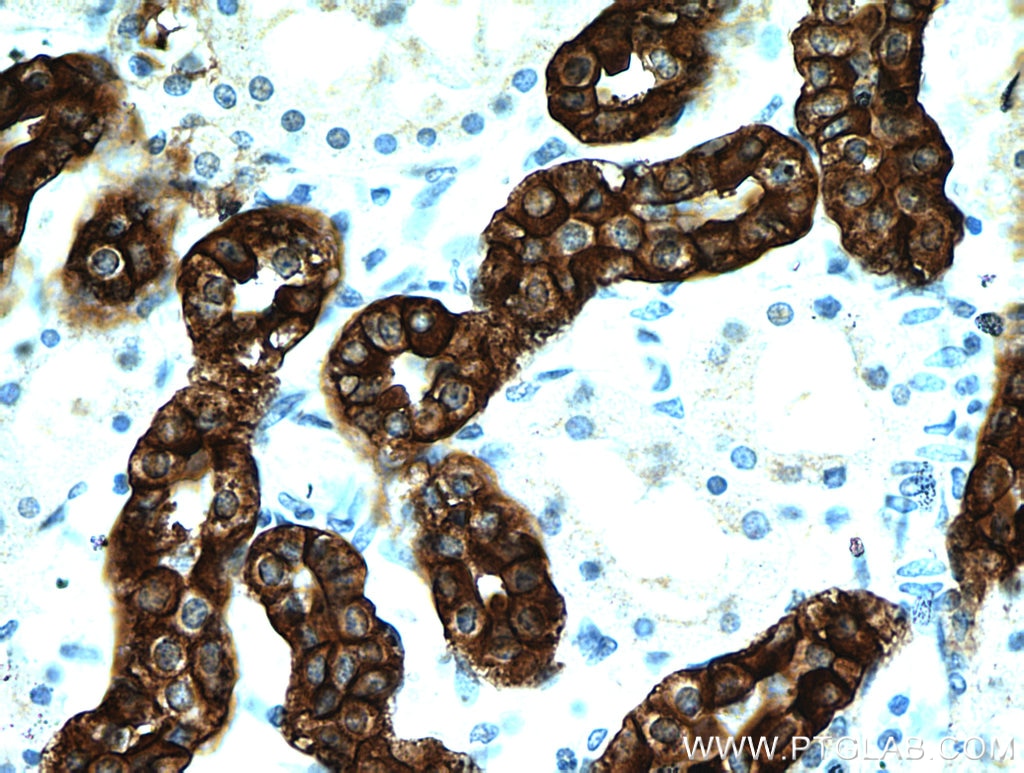 Immunohistochemistry (IHC) staining of human kidney tissue using RHCG Polyclonal antibody (11949-1-AP)