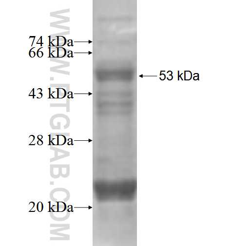 RHCG fusion protein Ag2493 SDS-PAGE