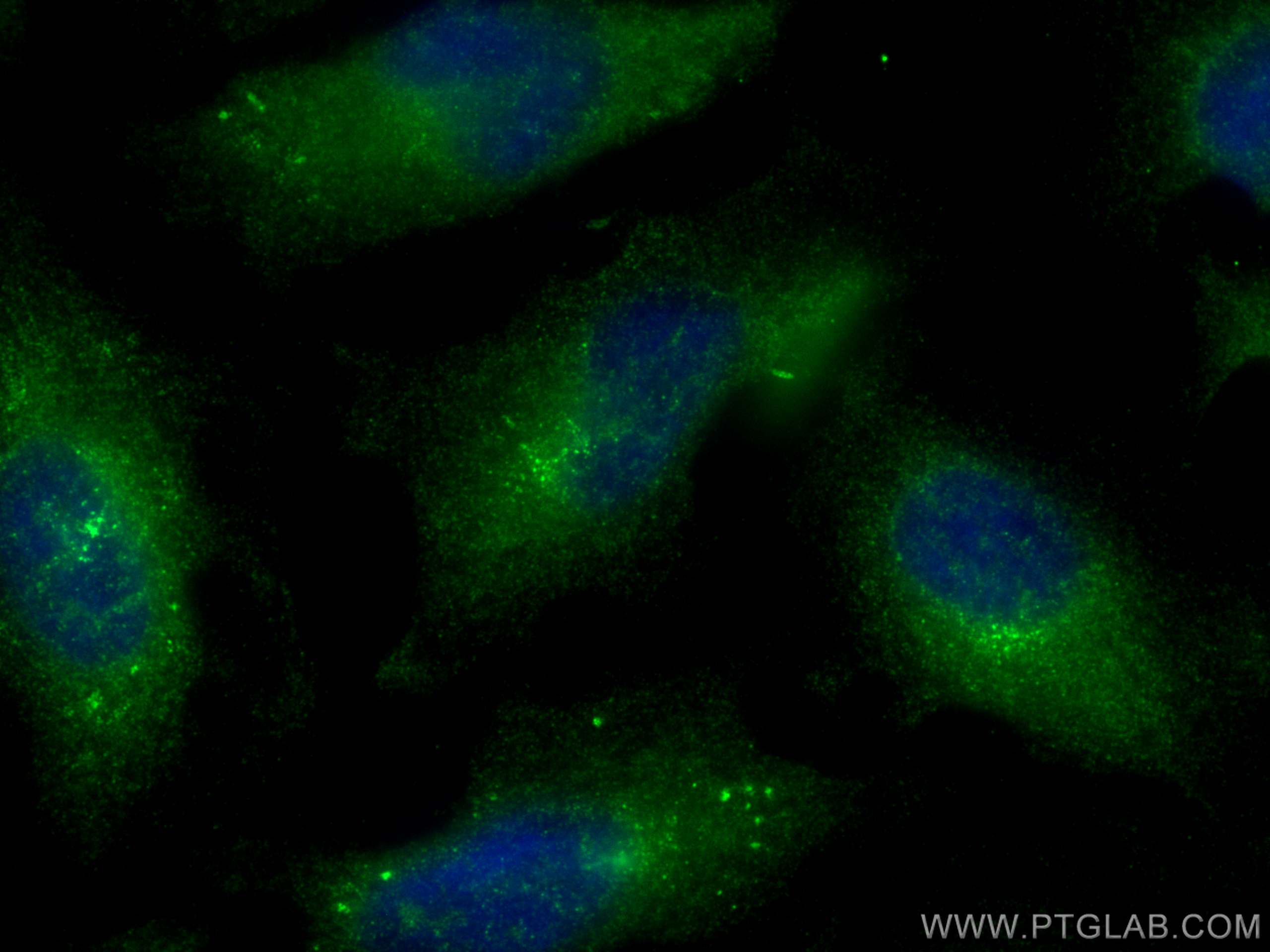 Immunofluorescence (IF) / fluorescent staining of HeLa cells using RHEB Polyclonal antibody (15924-1-AP)