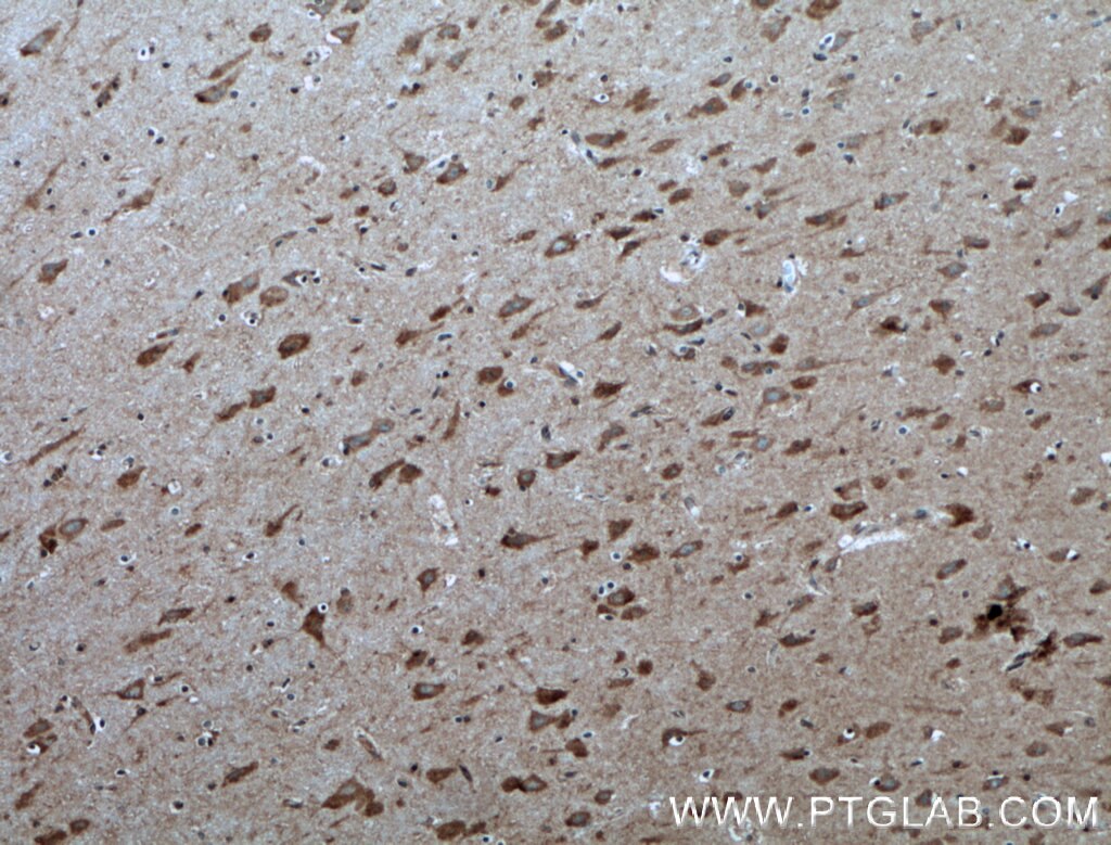 Immunohistochemistry (IHC) staining of human brain tissue using RHEB Polyclonal antibody (15924-1-AP)