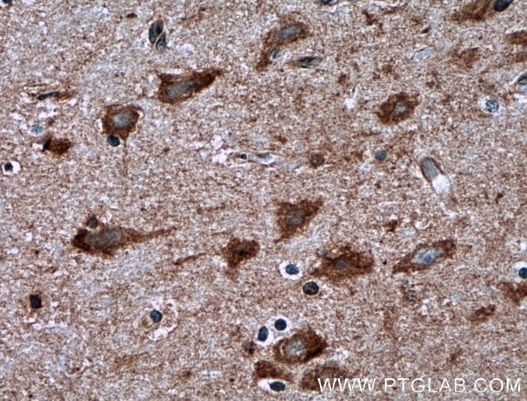 Immunohistochemistry (IHC) staining of human brain tissue using RHEB Polyclonal antibody (15924-1-AP)