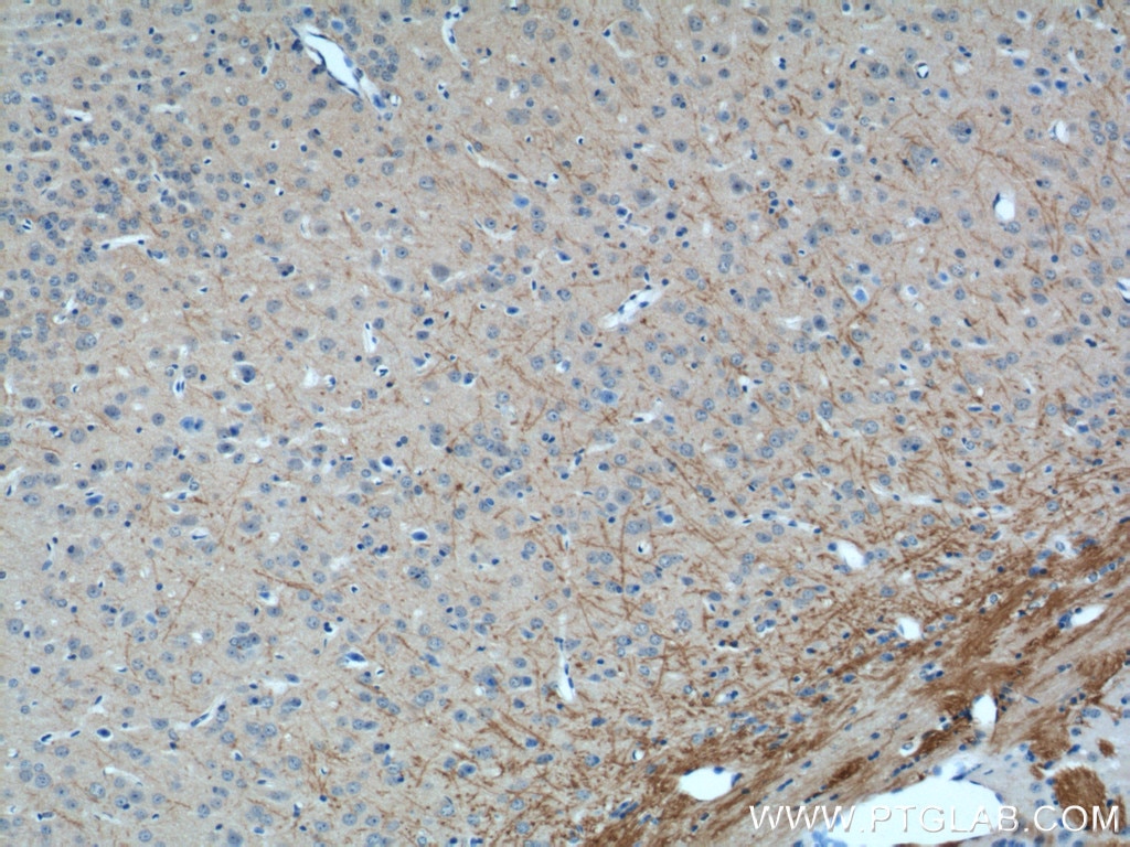 Immunohistochemistry (IHC) staining of mouse brain tissue using RHEB Polyclonal antibody (15924-1-AP)