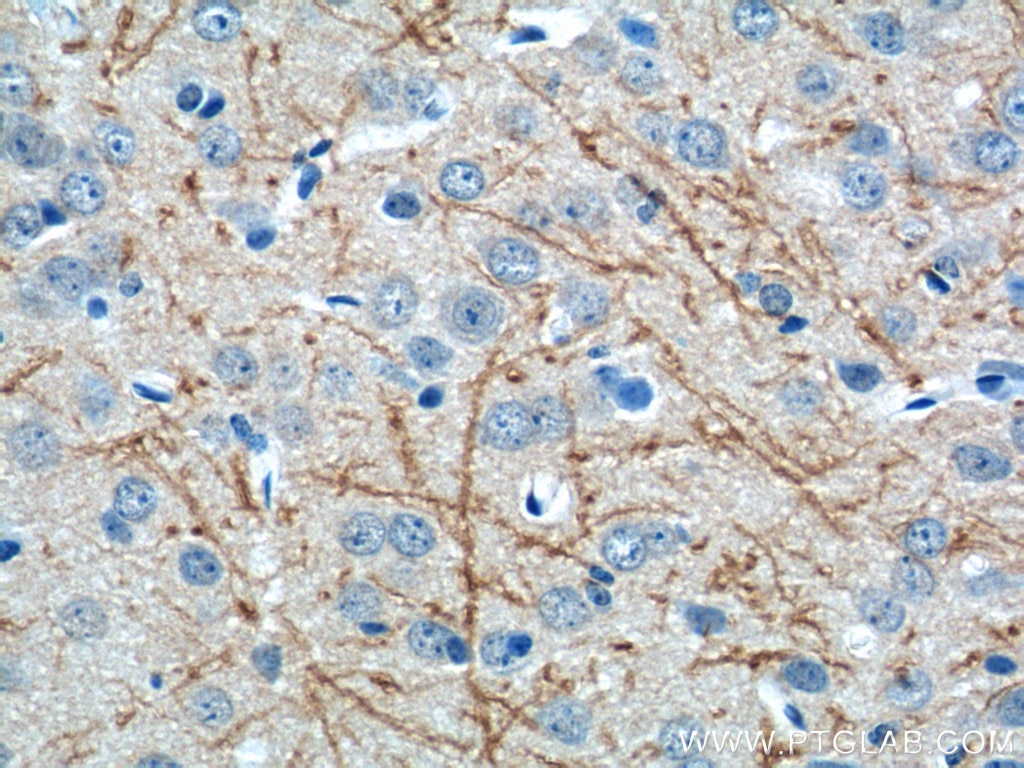 Immunohistochemistry (IHC) staining of mouse brain tissue using RHEB Polyclonal antibody (15924-1-AP)