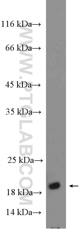 WB analysis of 3T3-L1 using 15924-1-AP