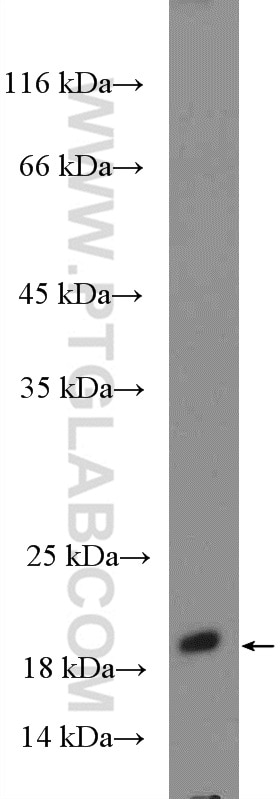 Western Blot (WB) analysis of fetal human brain tissue using RHEB Polyclonal antibody (15924-1-AP)