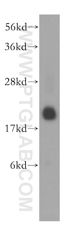 Western Blot (WB) analysis of human brain tissue using RHEB Polyclonal antibody (15924-1-AP)