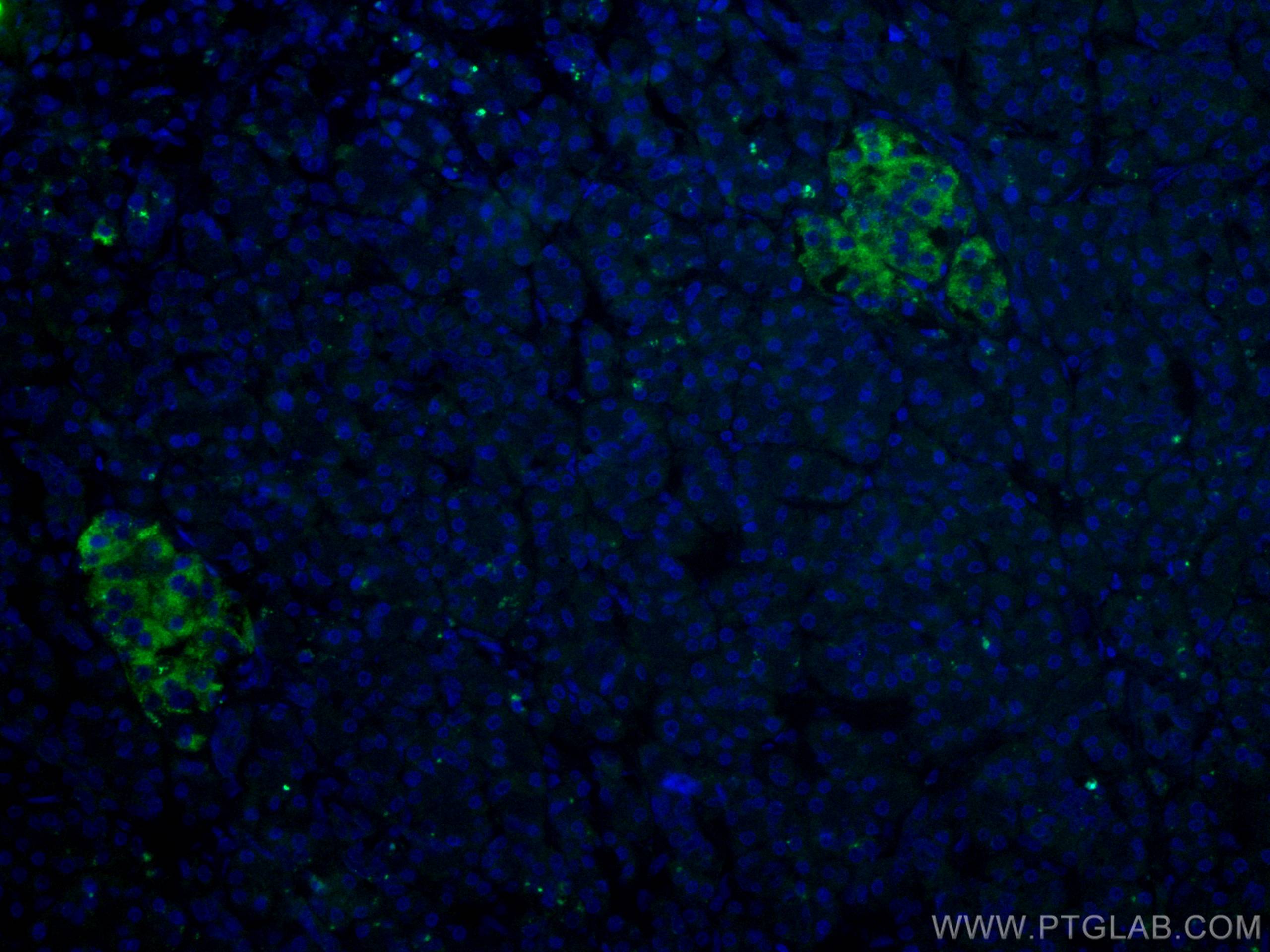 Immunofluorescence (IF) / fluorescent staining of human pancreas cancer tissue using RHEB Monoclonal antibody (66714-1-Ig)
