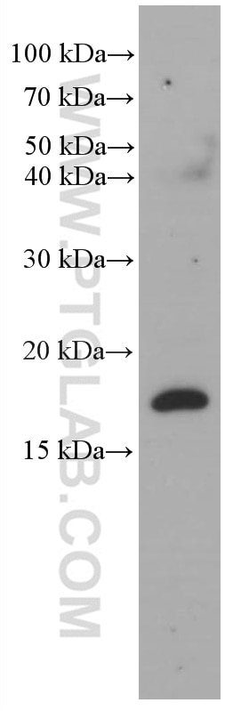 Western Blot (WB) analysis of fetal human brain tissue using RHEB Monoclonal antibody (66714-1-Ig)