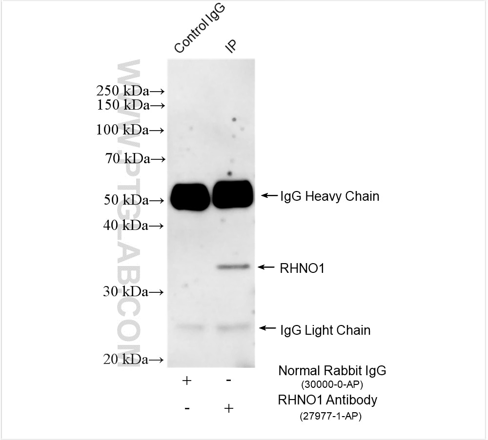 Immunoprecipitation (IP) experiment of mouse thymus tissue using RHNO1 Polyclonal antibody (27977-1-AP)