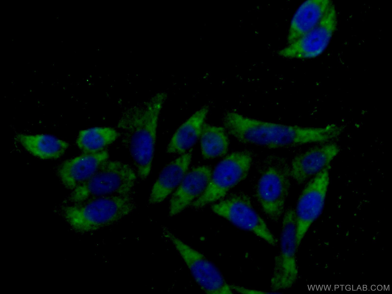 Immunofluorescence (IF) / fluorescent staining of HeLa cells using RHOA Polyclonal antibody (10749-1-AP)