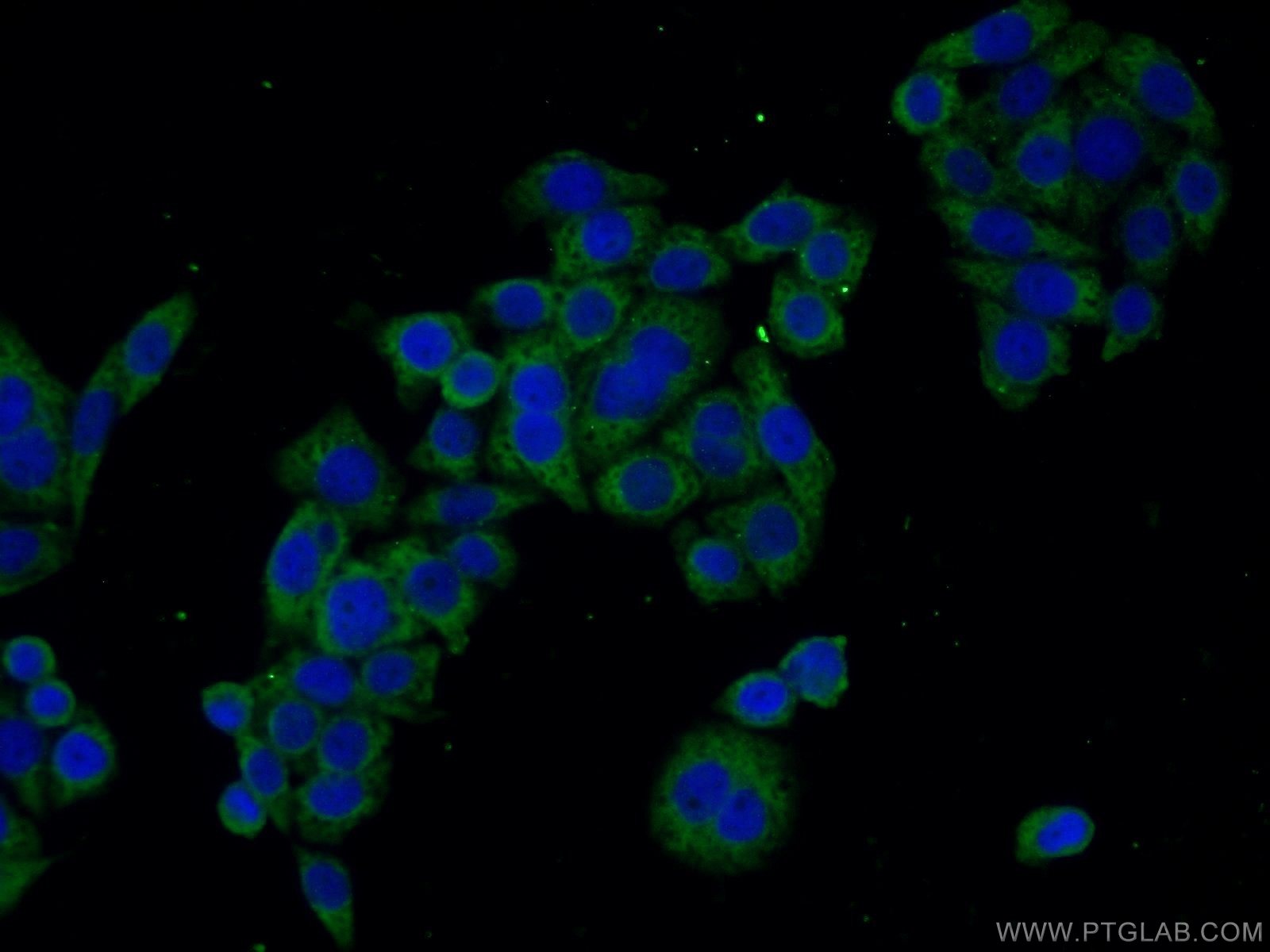 RHOA Polyclonal antibody