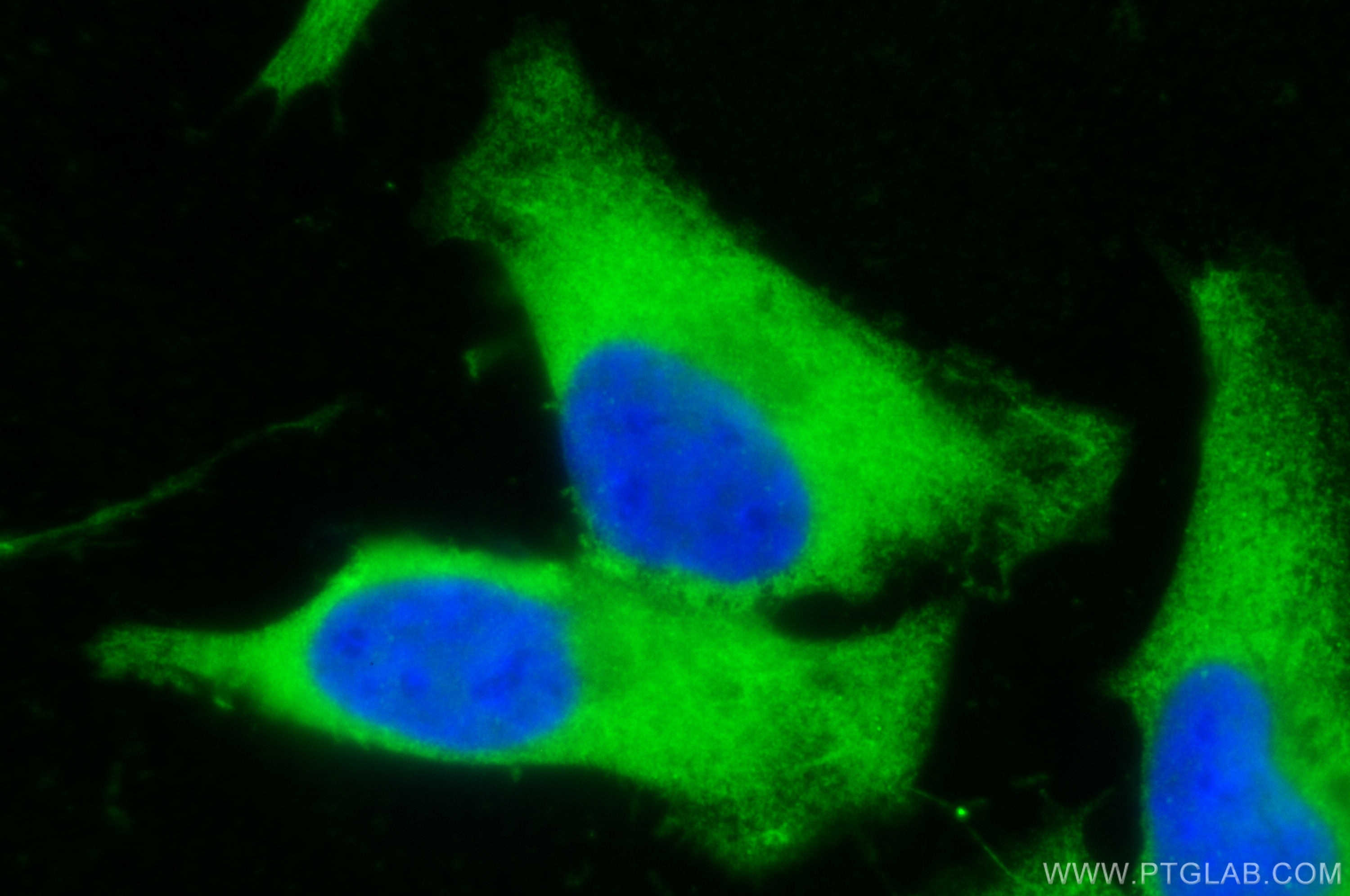 Immunofluorescence (IF) / fluorescent staining of HeLa cells using RHOA Polyclonal antibody (10749-1-AP)