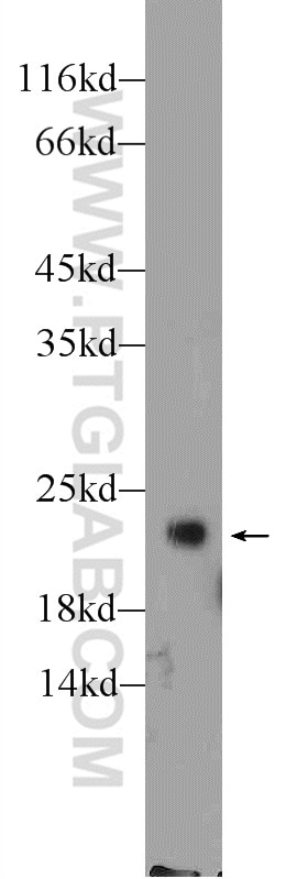 Western Blot (WB) analysis of rat brain tissue using RHOA Polyclonal antibody (10749-1-AP)