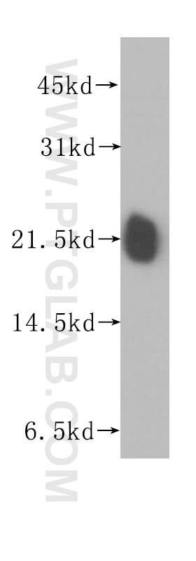 RHOA Polyclonal antibody