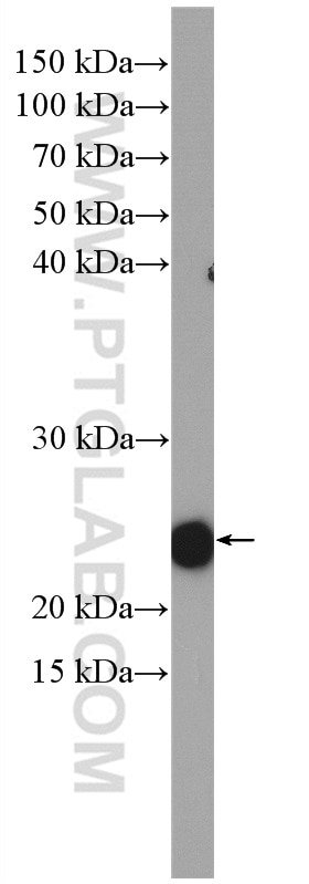 Western Blot (WB) analysis of mouse kidney tissue using RHOA Polyclonal antibody (27213-1-AP)