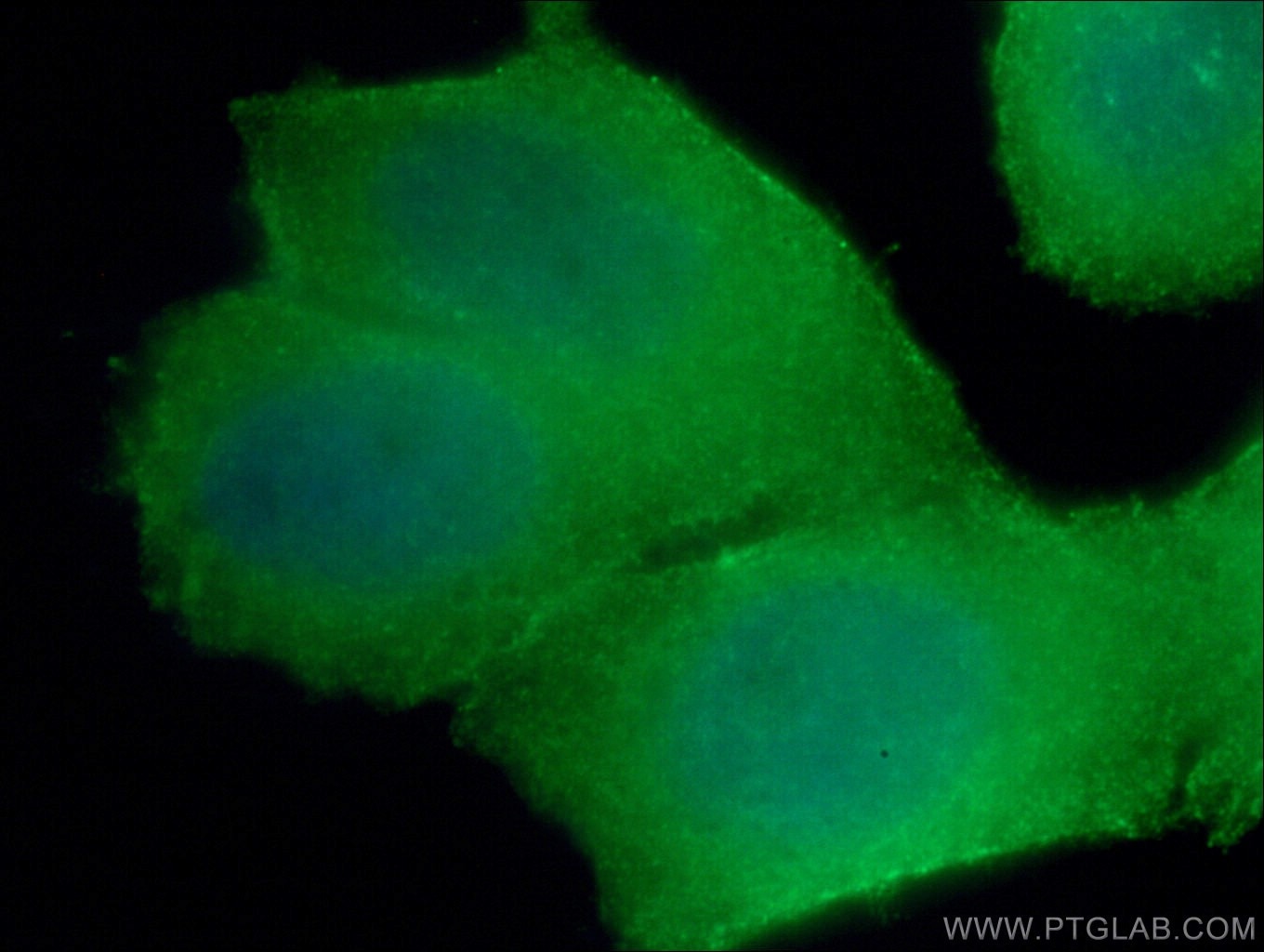 Immunofluorescence (IF) / fluorescent staining of HeLa cells using RHOA Monoclonal antibody (66733-1-Ig)