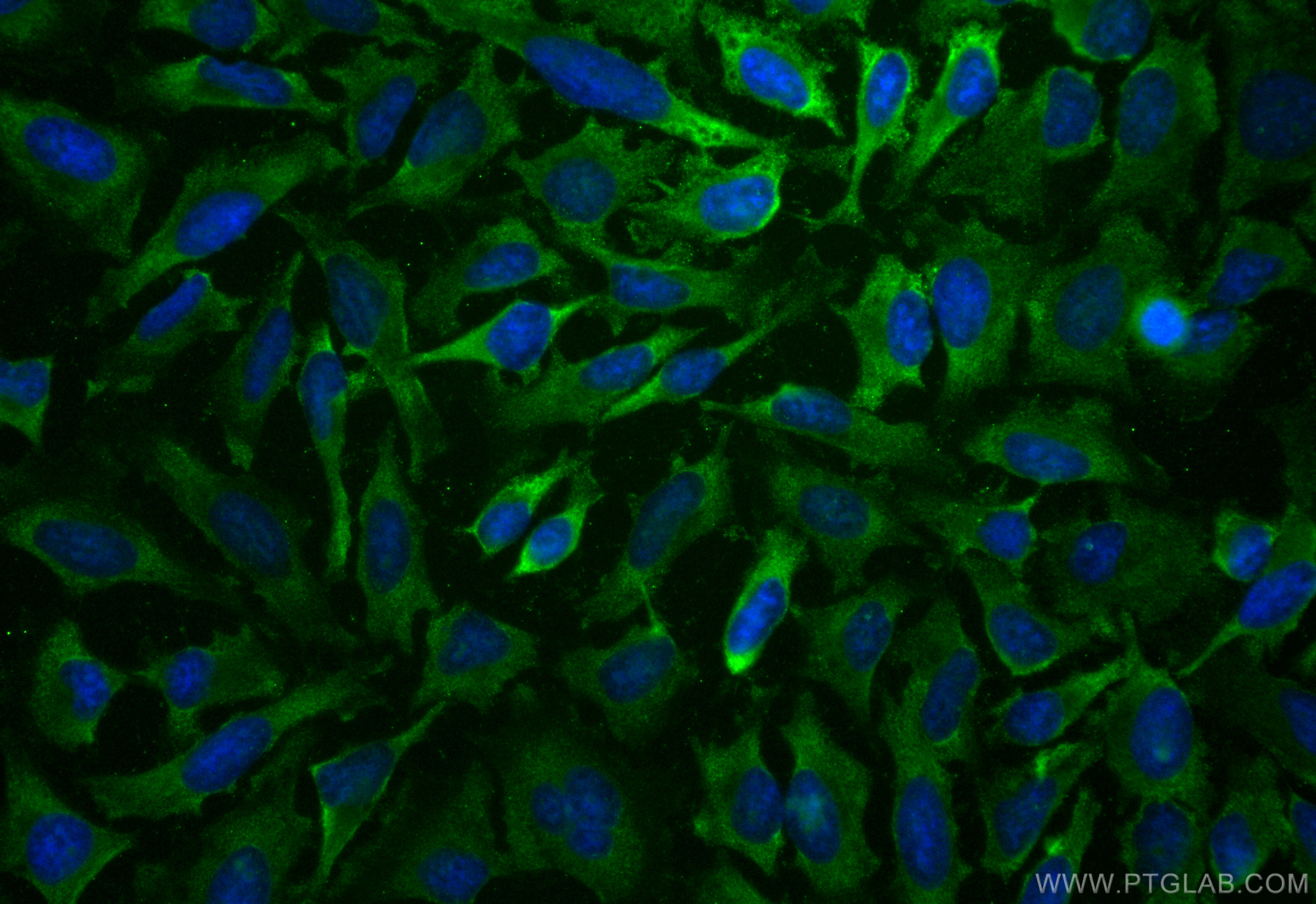 Immunofluorescence (IF) / fluorescent staining of HeLa cells using CoraLite® Plus 488-conjugated RHOA Recombinant ant (CL488-82760-2)