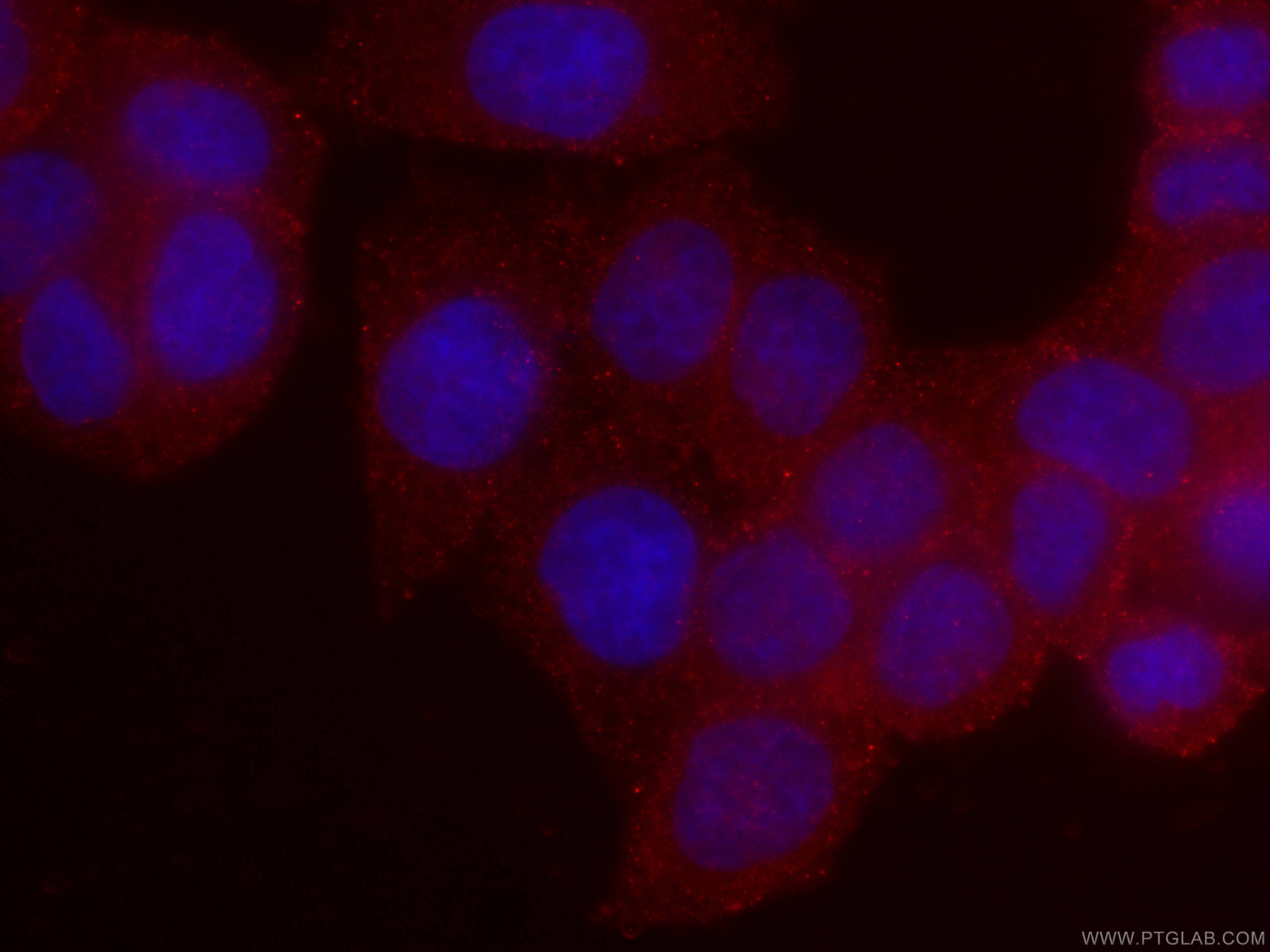 Immunofluorescence (IF) / fluorescent staining of HeLa cells using CoraLite®594-conjugated RHOA Monoclonal antibody (CL594-66733)