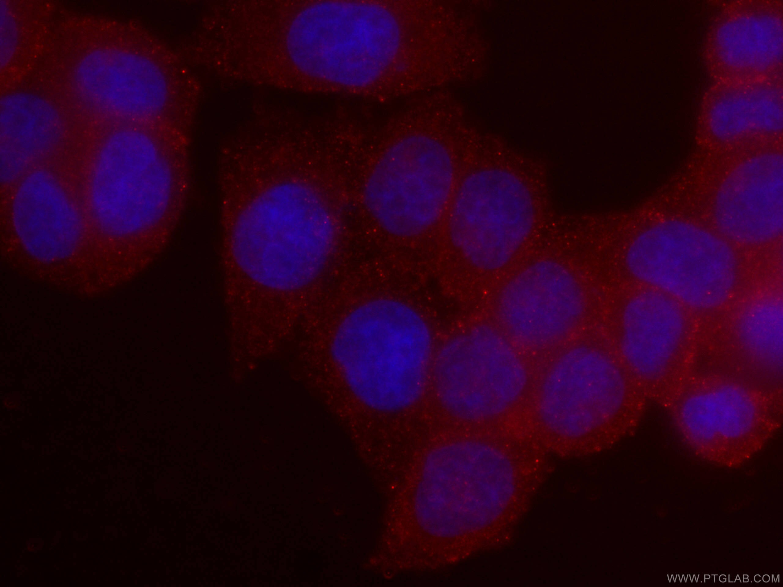 Immunofluorescence (IF) / fluorescent staining of HeLa cells using CoraLite®594-conjugated RHOA Monoclonal antibody (CL594-66733)