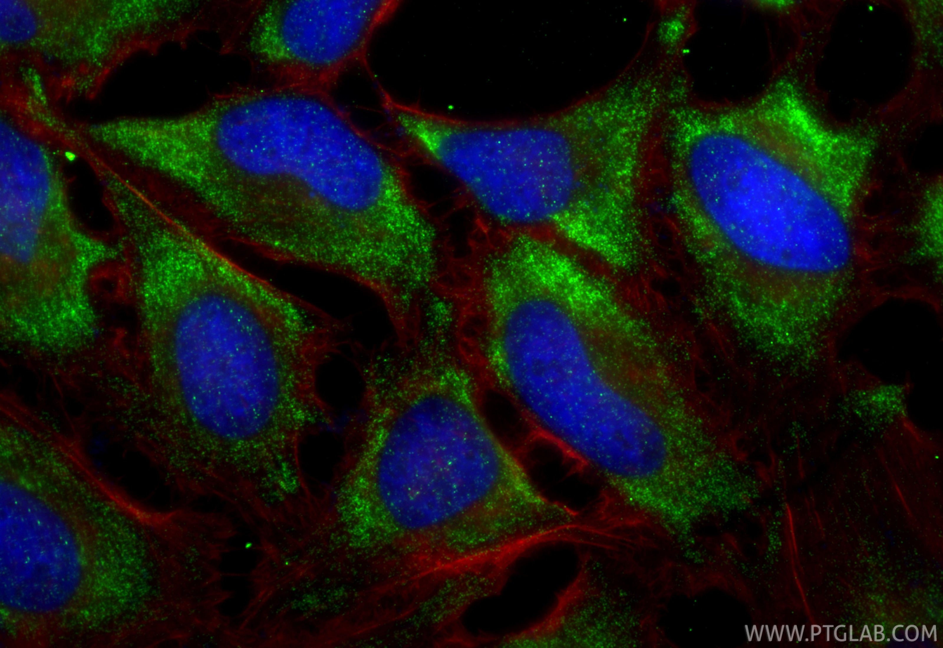 IF Staining of HeLa using RMX00030 Immunofluorescence (IF) / fluorescent staining of HeLa cells using Multi-rAb™ RHOA Multi-Recombinant antibody (RMX00030)