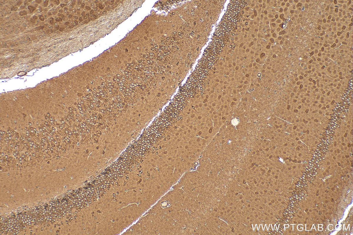 IHC staining of mouse brain using RMX00030 Immunohistochemistry (IHC) staining of mouse brain tissue using RHOA Multi-Recombinant antibody (RMX00030)