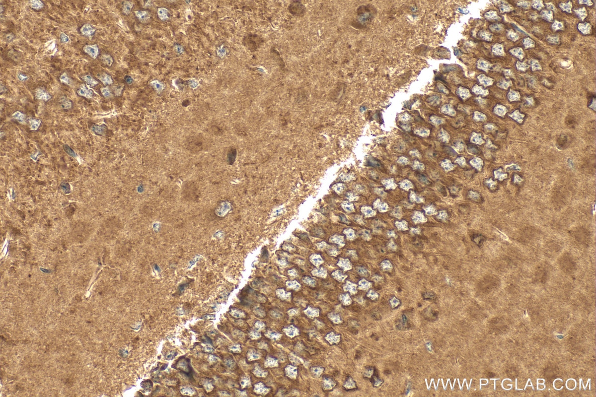 IHC staining of mouse brain using RMX00030 Immunohistochemistry (IHC) staining of mouse brain tissue using Multi-rAb™ RHOA Multi-Recombinant antibody (RMX00030)