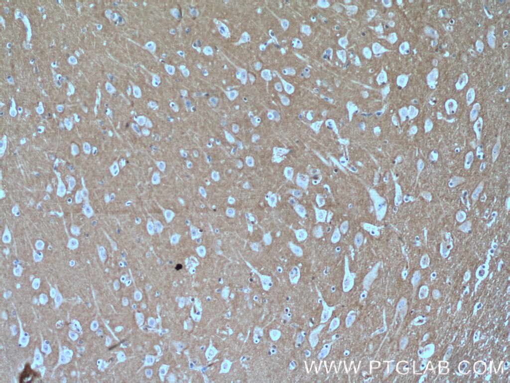 Immunohistochemistry (IHC) staining of human brain tissue using RHOB Polyclonal antibody (14326-1-AP)