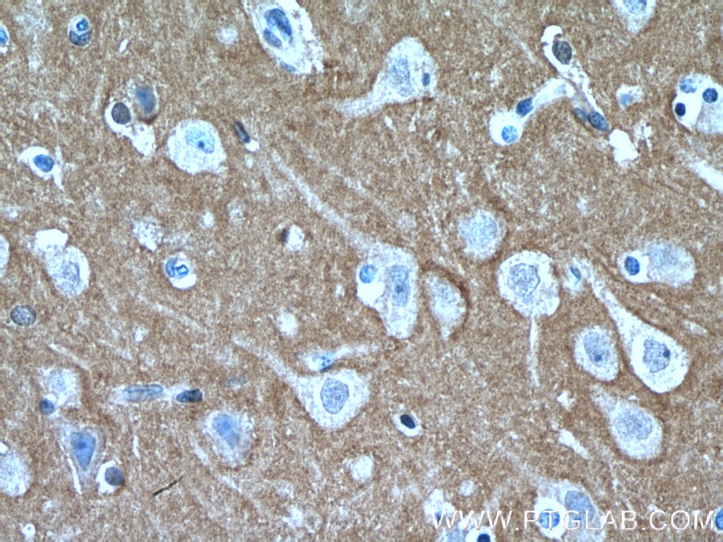 Immunohistochemistry (IHC) staining of human brain tissue using RHOB Polyclonal antibody (14326-1-AP)