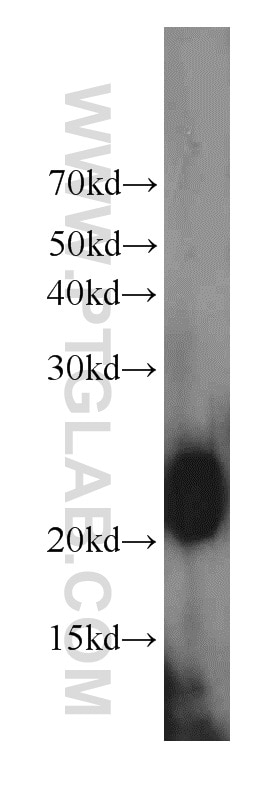 Western Blot (WB) analysis of HeLa cells using RHOB Polyclonal antibody (14326-1-AP)