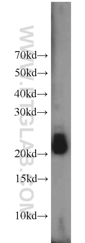 Western Blot (WB) analysis of SH-SY5Y cells using RHOB Polyclonal antibody (14326-1-AP)