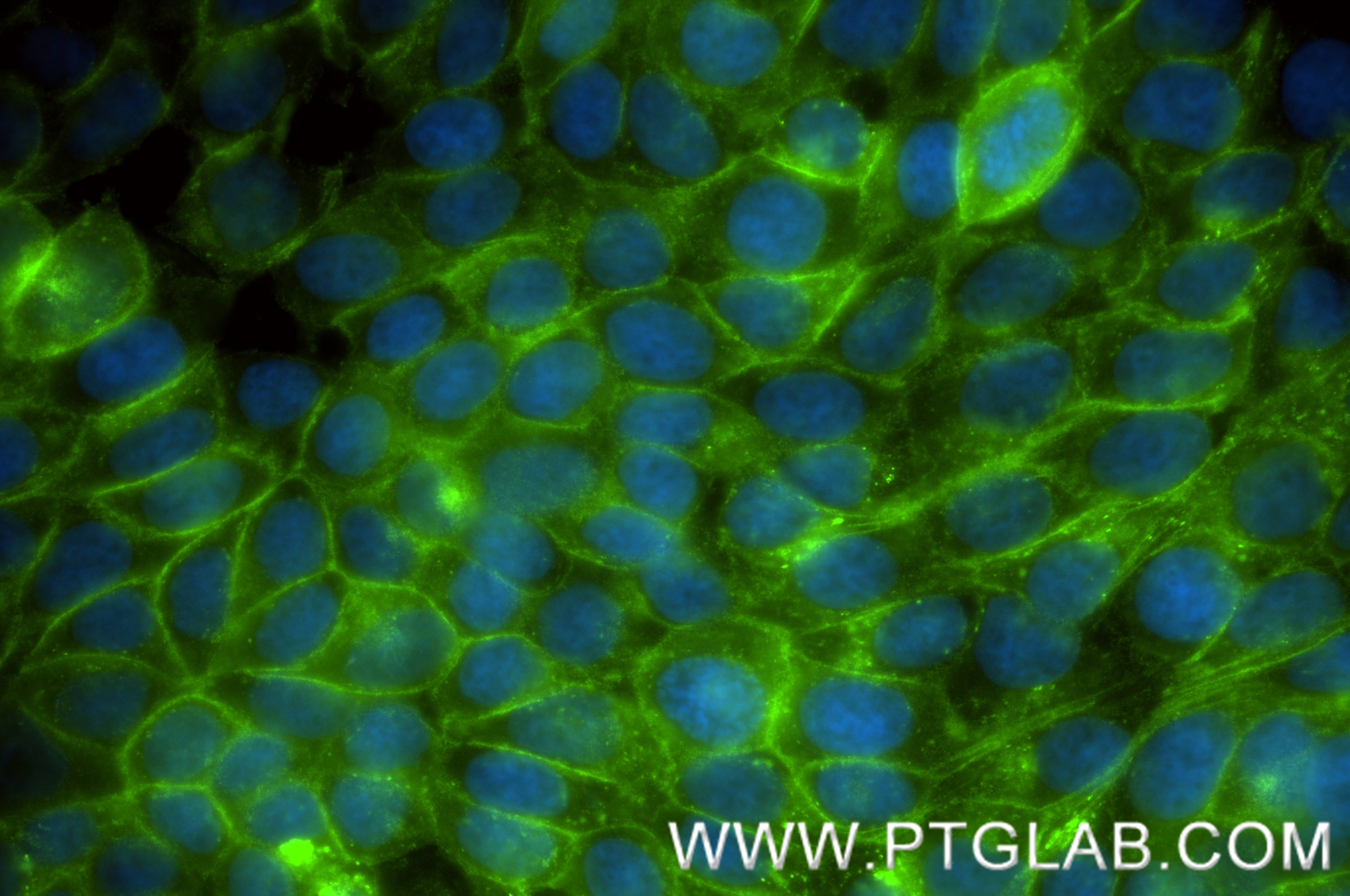IF Staining of MCF-7 using 86663-4-RR Immunofluorescence (IF) / fluorescent staining of MCF-7 cells using RHOB Recombinant monoclonal antibody (86663-4-RR)