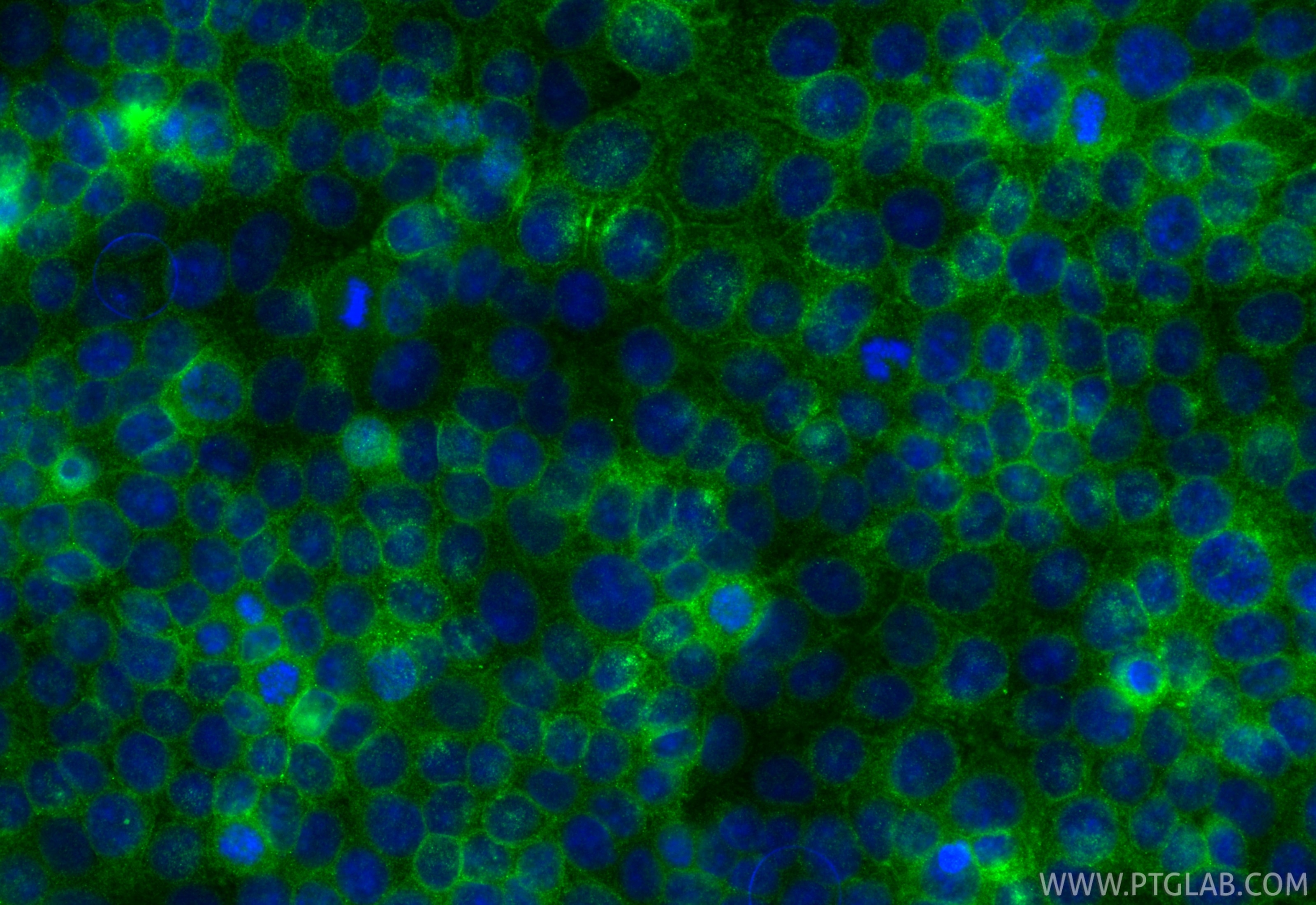 IF Staining of MCF-7 using RMX00061 Immunofluorescence (IF) / fluorescent staining of MCF-7 cells using Multi-rAb® RHOB Multi-Recombinant antibody (RMX00061)