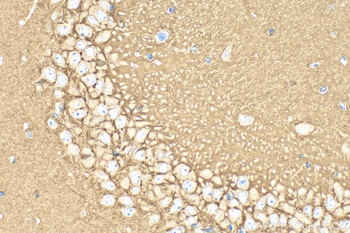 IHC staining of mouse brain using RMX00061 Immunohistochemistry (IHC) staining of mouse brain tissue using Multi-rAb® RHOB Multi-Recombinant antibody (RMX00061)