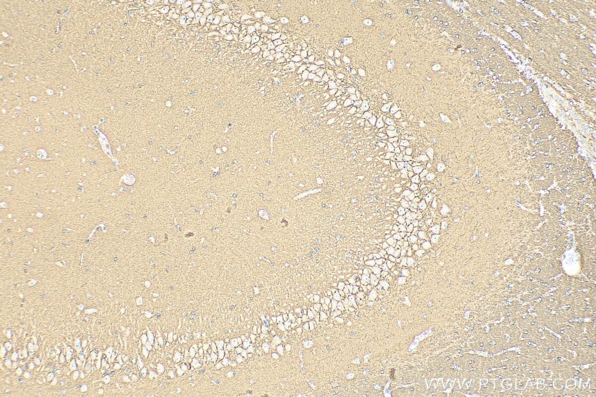 IHC staining of rat brain using RMX00061 Immunohistochemistry (IHC) staining of rat brain tissue using Multi-rAb® RHOB Multi-Recombinant antibody (RMX00061)