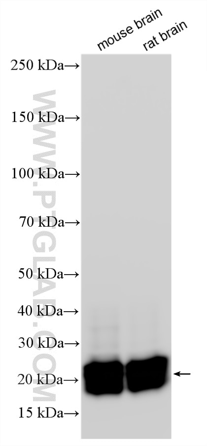 WB analysis using RMX00061 Western Blot (WB) analysis of various lysates using Multi-rAb® RHOB Multi-Recombinant antibody (RMX00061)