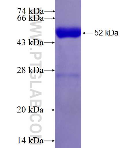 RHOB fusion protein Ag5593 SDS-PAGE