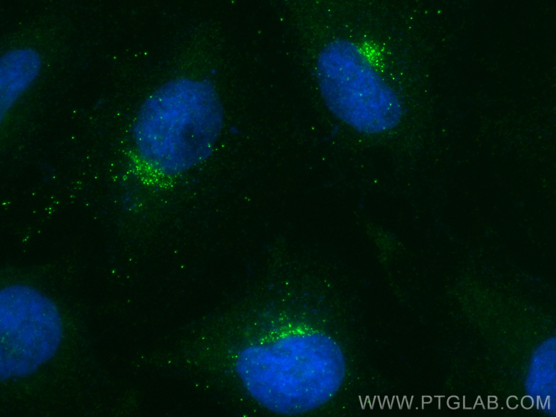 Immunofluorescence (IF) / fluorescent staining of HeLa cells using RHOBTB1 Recombinant antibody (83342-1-RR)