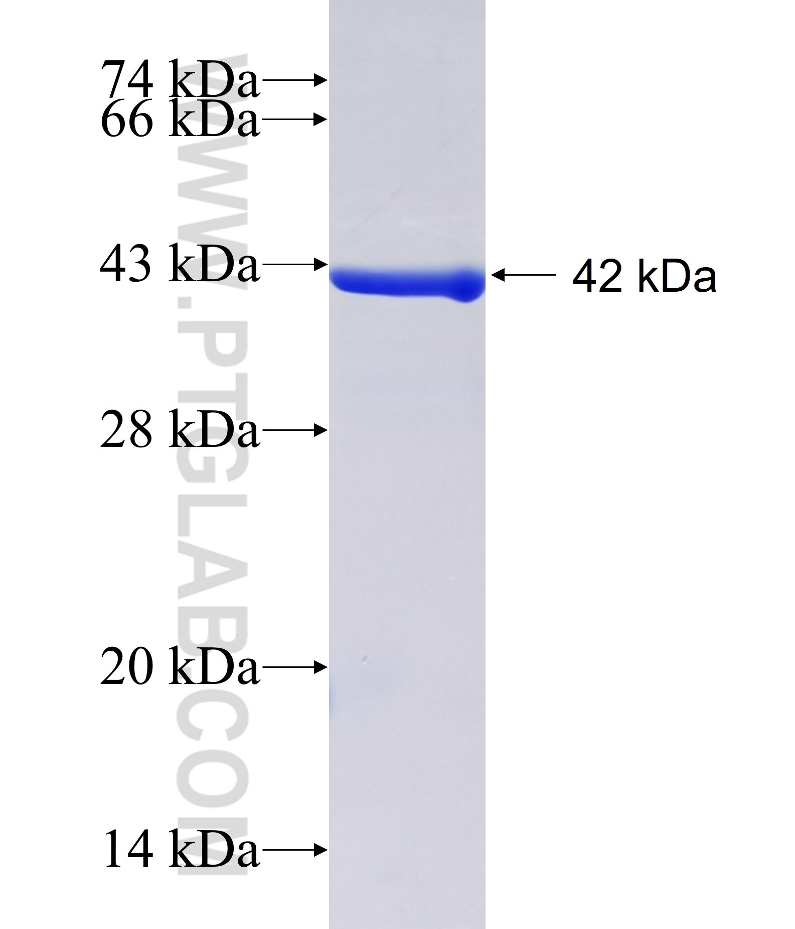 RHOBTB2 fusion protein Ag38531 SDS-PAGE RHOBTB2 fusion protein Ag38531 SDS-PAGE