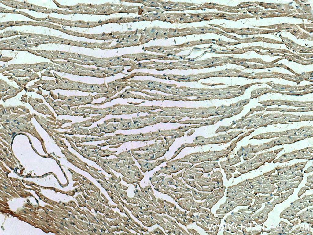 Immunohistochemistry (IHC) staining of mouse heart tissue using RHOBTB3 Polyclonal antibody (13945-1-AP)